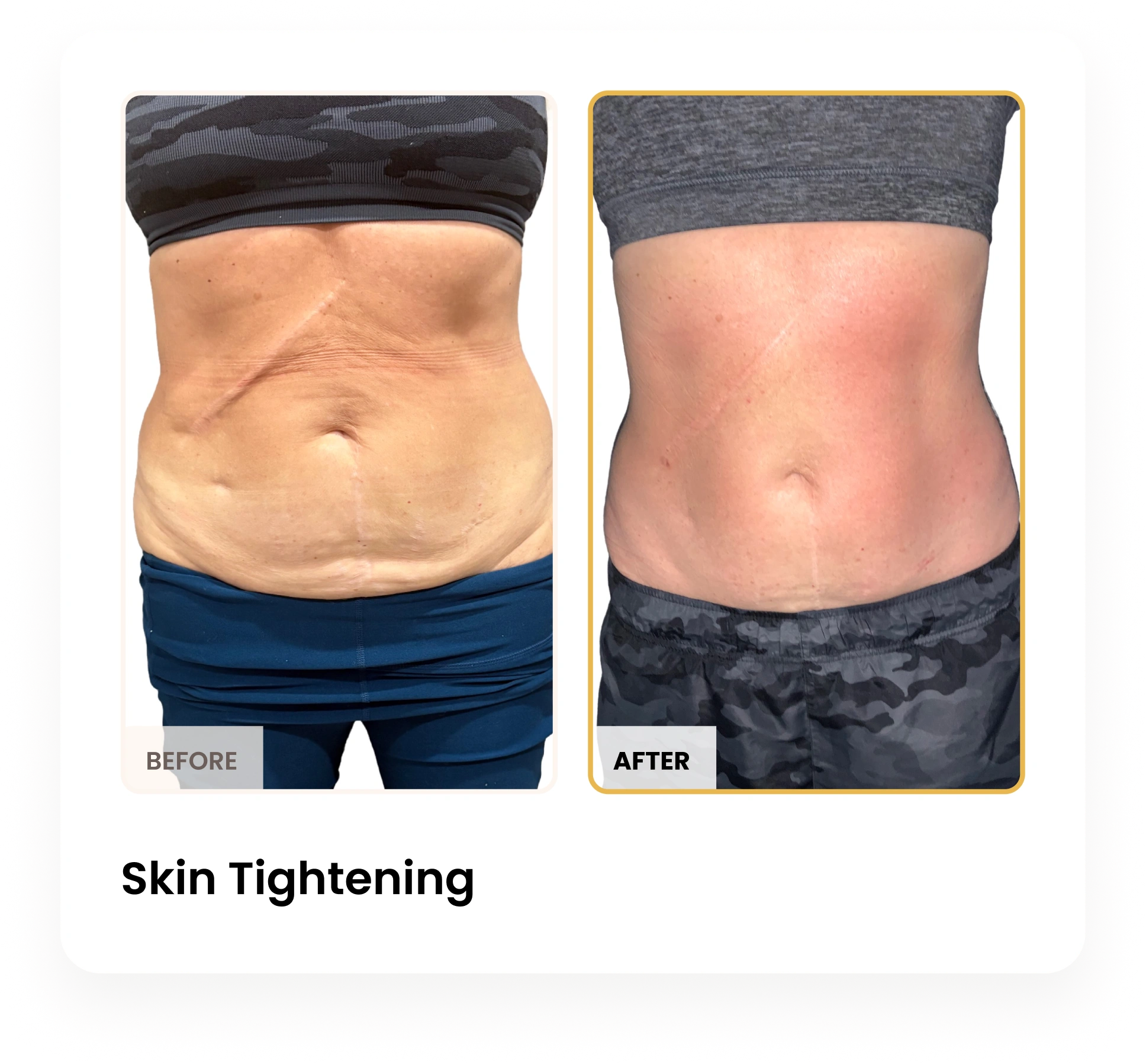 Treatment Card (1)