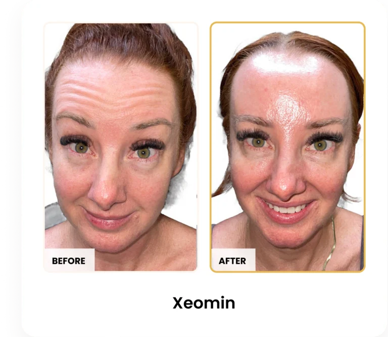 Treatment Card (12)