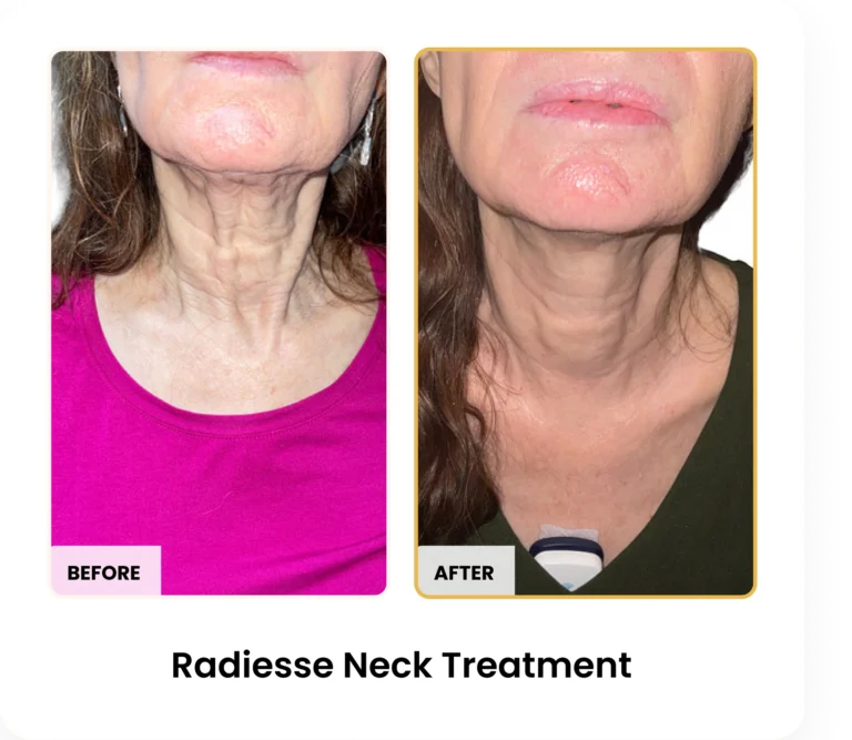 Treatment Card (13)