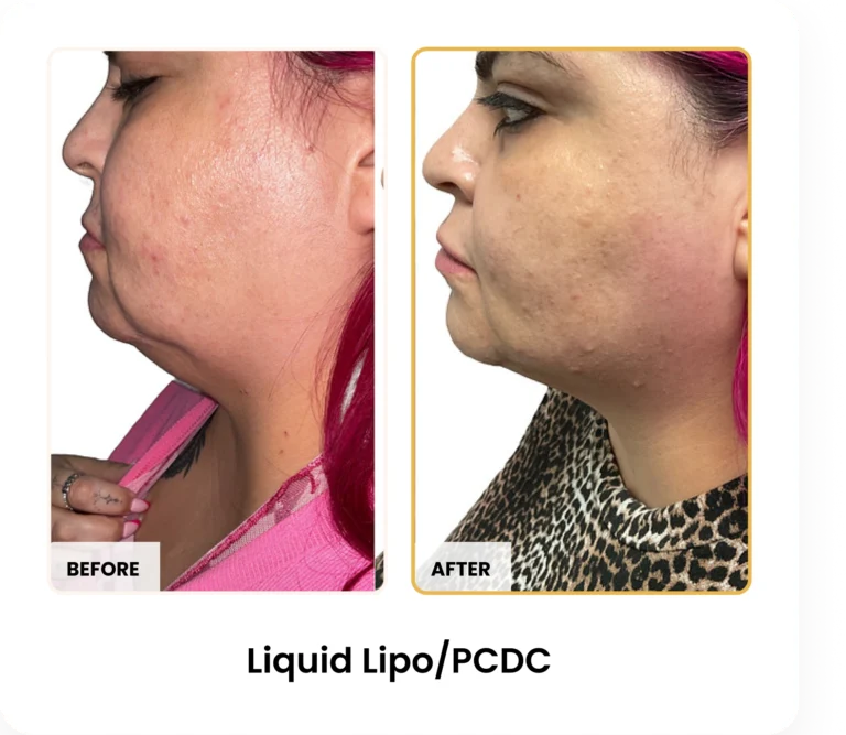 Treatment Card (16)