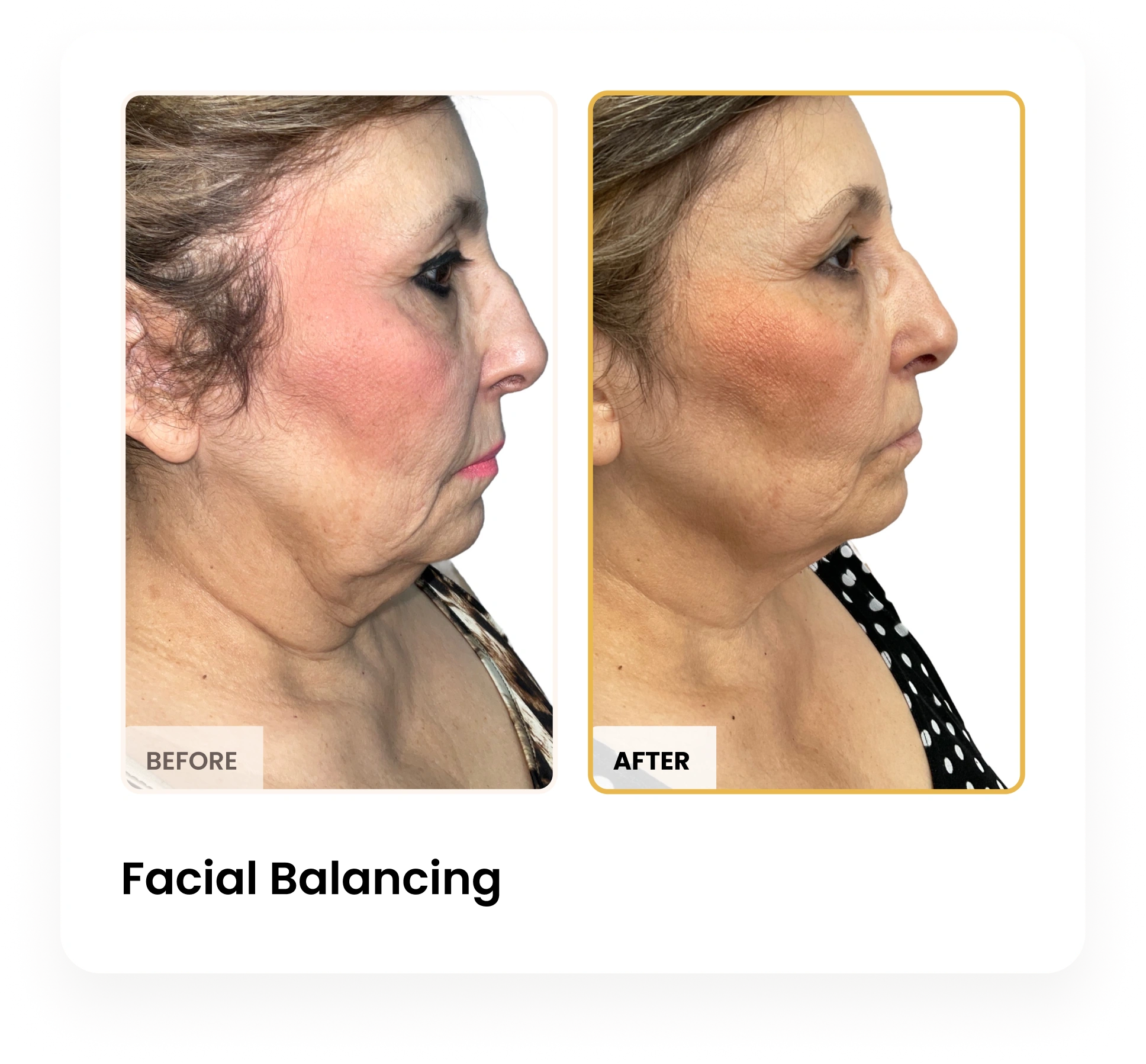 Treatment Card (2)
