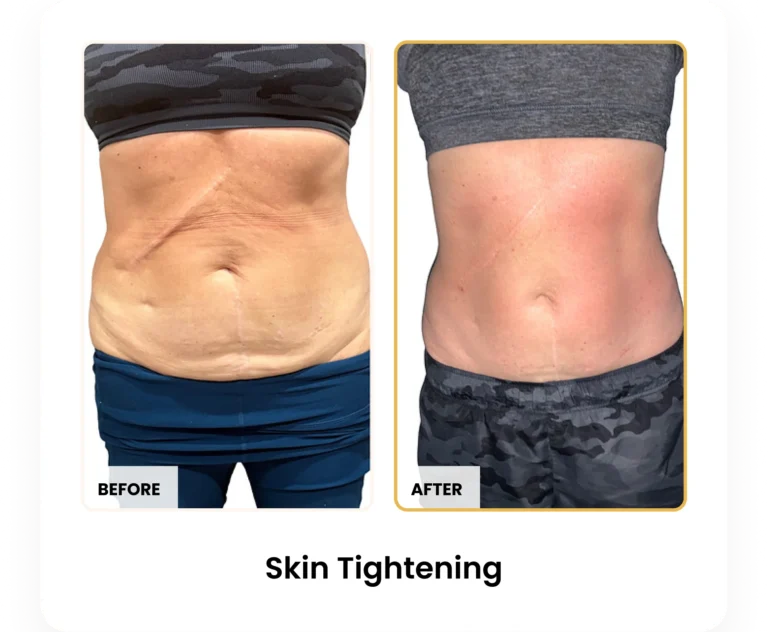 Treatment Card (20)