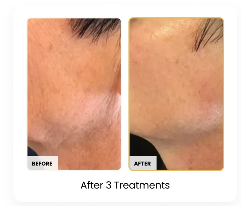 Treatment Card (21)