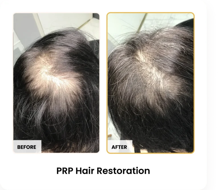 Treatment Card (30)